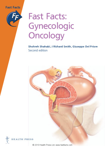 Fast Facts: Gynecologic Oncology