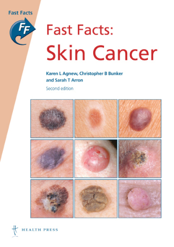 Fast Facts: Skin Cancer : Skin Cancer