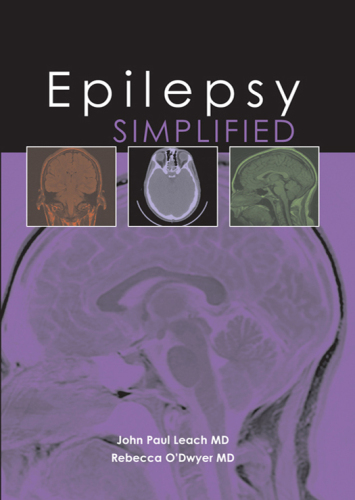 Epilepsy Simplified