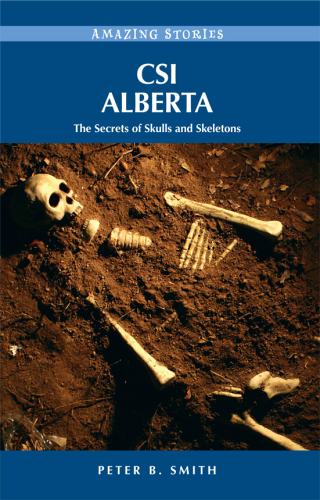 CSI Alberta. The Secrets of Skulls and Skeletons