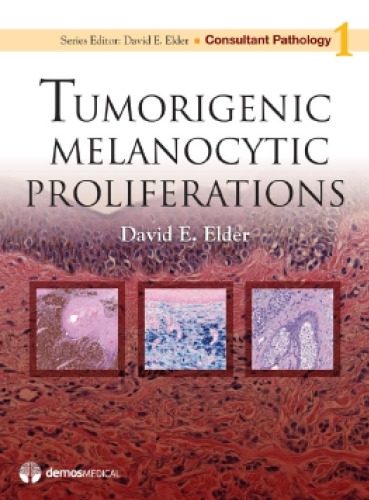 Tumorigenic Melanocytic Proliferations