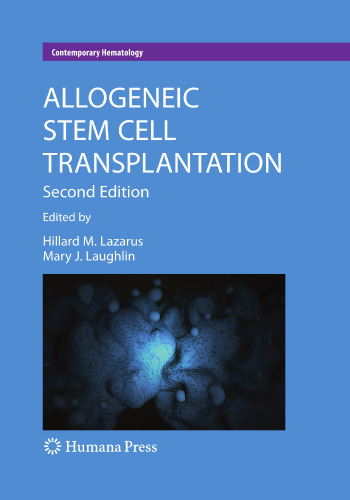 Allogeneic Stem Cell Transplantation