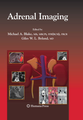 Adrenal Imaging