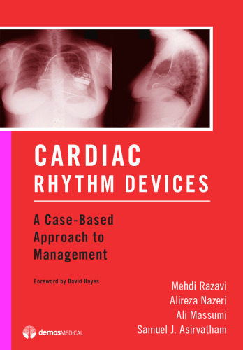 Cardiac Rhythm Devices : A Case-Based Approach to Management