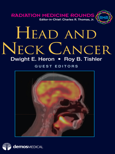 Head and Neck Cancer