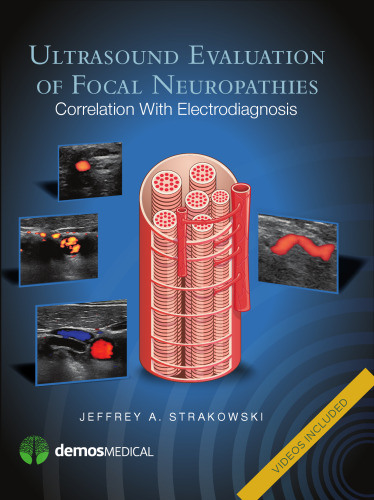 Ultrasound Evaluation of Focal Neuropathies: Correlation with Electrodiagnosis