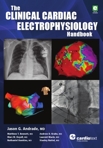 Clinical cardiac electrophysiology handbook