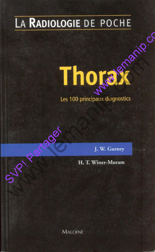 Thorax: les 100 principaux diagnostics