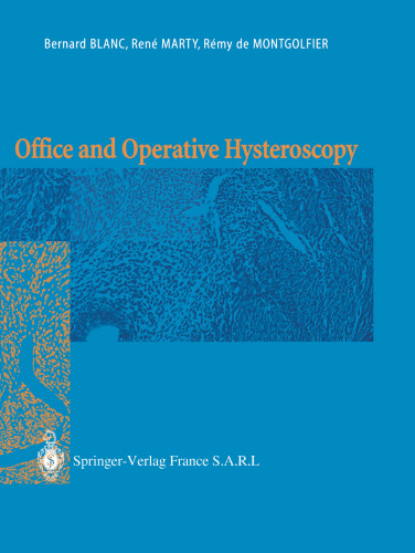 Office and Operative Hysteroscopy
