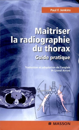 Maîtriser la radiographie du thorax : guide pratique