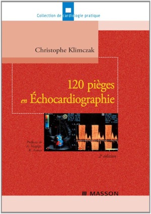 120 pieges en echocardiographie
