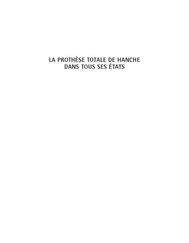 La Prothèse Totale de Hanche dans Tous ses états