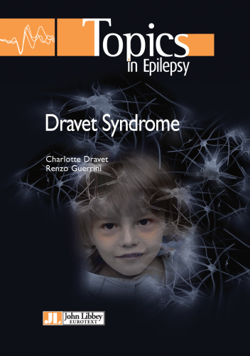 Dravet Syndrome