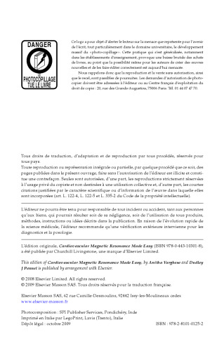 IRM Cardiovasculaire Facile