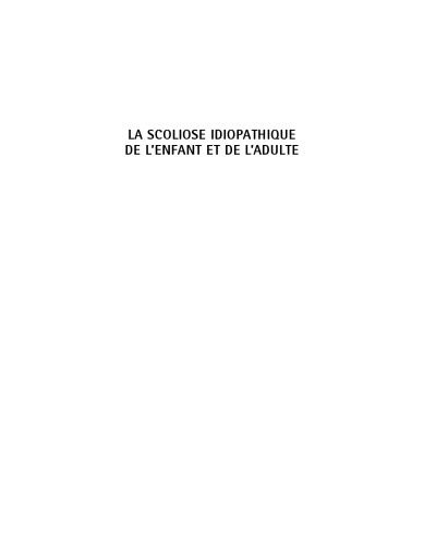 La scoliose idiopathique de l'enfant et de l'adulte