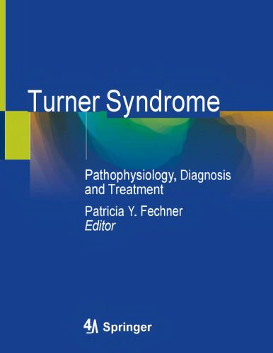 Turner Syndrome - Pathophysiology, Diagnosis and Treatment (Mar 21, 2020)_(303034150X)_(Springer).pdf