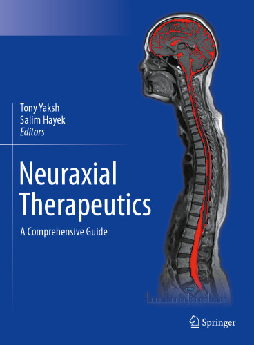 Neuraxial Therapeutics - A Comprehensive Guide (Jan 3, 2024)_(3031395573)_(Springer)