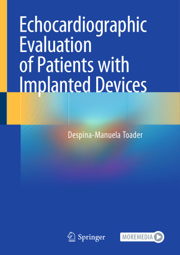 Echocardiographic Evaluation of Patients with Implanted Devices