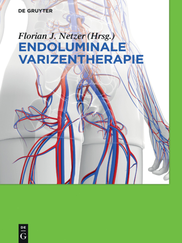 Endoluminale Varizentherapie
