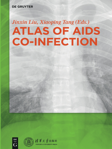 Atlas of AIDS Co-infection