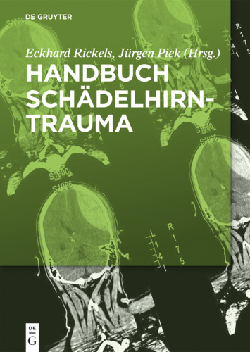 Handbuch Schädelhirntrauma
