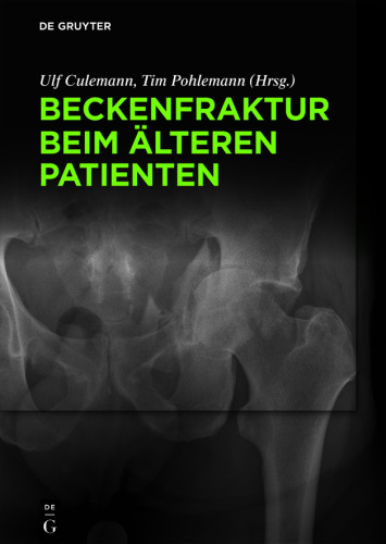 Beckenfraktur beim älteren Patienten