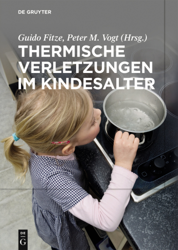 Thermische Verletzungen im Kindesalter