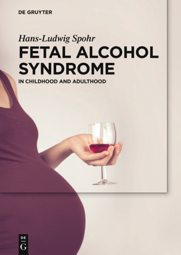 Fetal Alcohol Syndrome: A lifelong Challenge