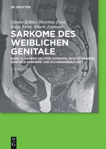 Sarkome des weiblichen Genitale: Band 2 Andere seltene Sarkome, Mischtumoren, genitale Sarkome und Schwangerschaft