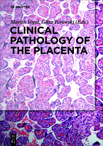 Clinical Pathology of the Placenta