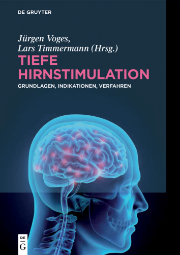 Tiefe Hirnstimulation: Grundlagen, Indikationen, Verfahren