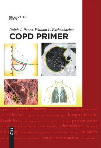 A COPD Primer