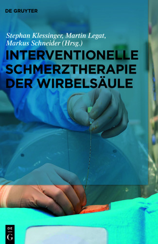 Interventionelle Schmerztherapie der Wirbelsäule