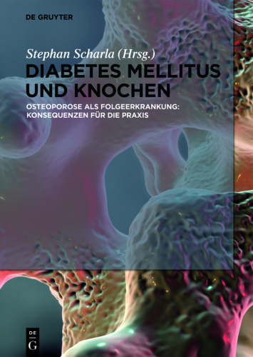 Diabetes Mellitus und Knochen: Osteoporose als Folgeerkrankung: Konsequenzen für die Praxis