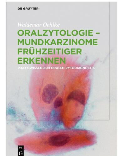 Oralzytologie - Mundkarzinome frühzeitiger erkennen: Praxiswissen zur Oralen Zytodiagnostik