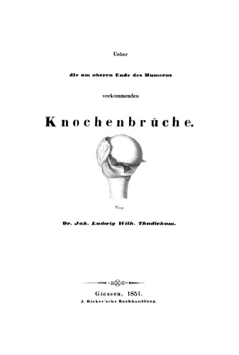Ueber die am oberen Ende des Humerus vorkommenden Knochenbrüche