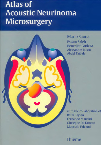 Atlas of Acoustic Neurinoma Microsurgery