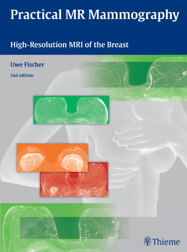 Practical MR mammography : high-resolution MRI of the breast