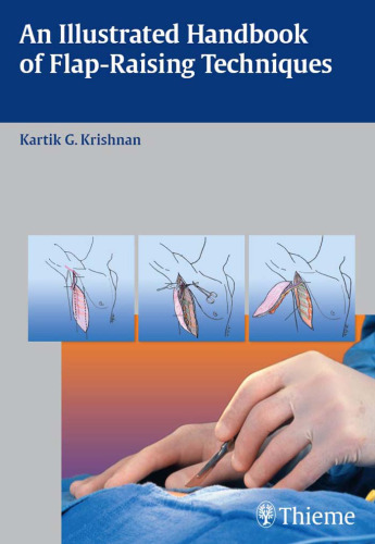 An illustrated handbook of flap-raising techniques