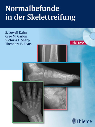 Normalbefunde in der Skelettreifung