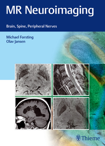 MR Neuroimaging: Brain, Spine, and Peripheral Nerves
