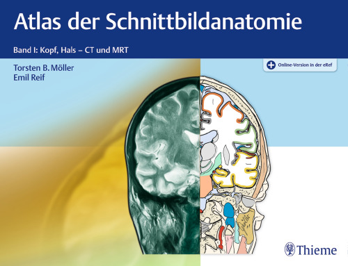 Atlas der Schnittbildanatomie: Band I: Kopf, Hals