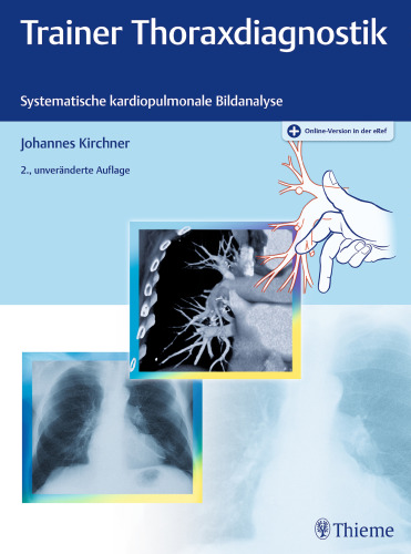 Trainer Thoraxdiagnostik: Systematische kardiopulmonale Bildanalyse. Plus Online-Version in der eRef