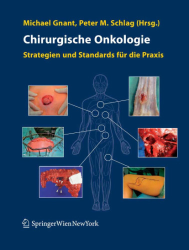 Chirurgische Onkologie: Strategien und Standards für die Praxis