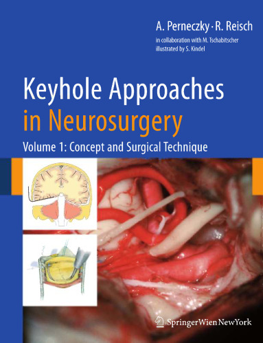 Keyhole Approaches in Neurosurgery: Volume I Concept and surgical technique