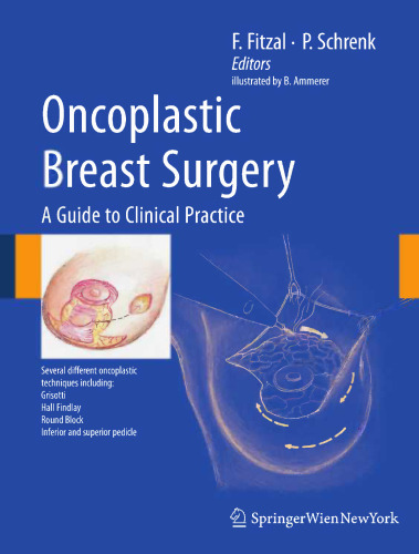 Oncoplastic Breast Surgery: A Guide to Clinical Practice