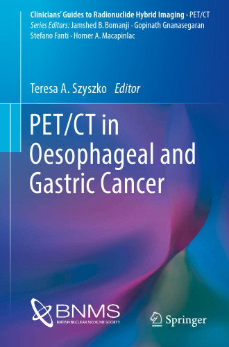 PET/CT in Oesophageal and Gastric Cancer (Clinicians’ Guides to Radionuclide Hybrid Imaging)