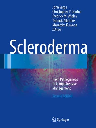 Scleroderma: From Pathogenesis to Comprehensive Management