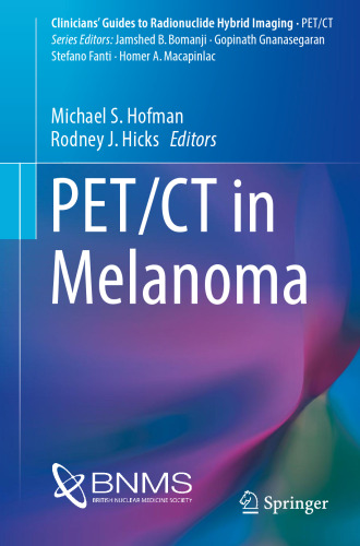 PET/CT in Melanoma (Clinicians’ Guides to Radionuclide Hybrid Imaging)