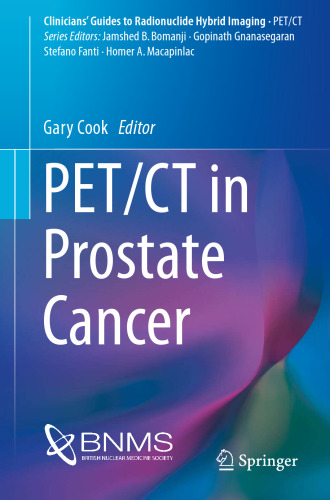 PET/CT in Prostate Cancer (Clinicians’ Guides to Radionuclide Hybrid Imaging)